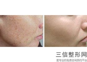 2022上海哪家整形医院做拉皮好？排行榜前十权威推荐