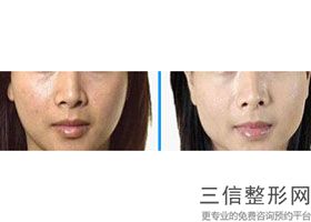 北京拉皮外科整形医院排名前十，北京哪家好
