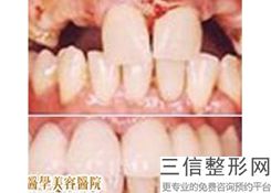 2022国内牙齿正畸医院排名榜前前八强名单解锁！