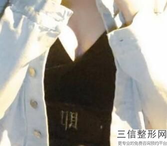 2022天津隆胸厉害的三家医院排行榜发布!前三名次有变化!