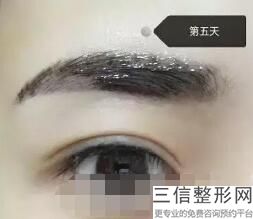 2022郑州双眼皮医院十强排行榜发布！医美top10口碑盘点！