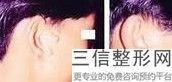 北京八大科室耳再造知名专家排名北京八大处是知名的整形机构