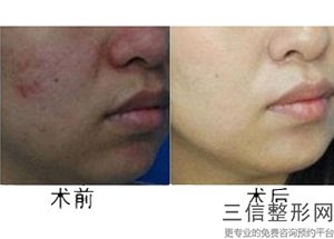 北京皮肤美容公立整形医院排名前十北京这样的医院