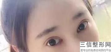 北京十大双眼皮专家排名前十韩新鸣医生甘承