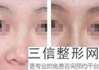 成都十大隆鼻医生排名前十，你知道几个？