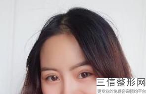 成都做双眼皮整形的10大医院，你知道吗？
