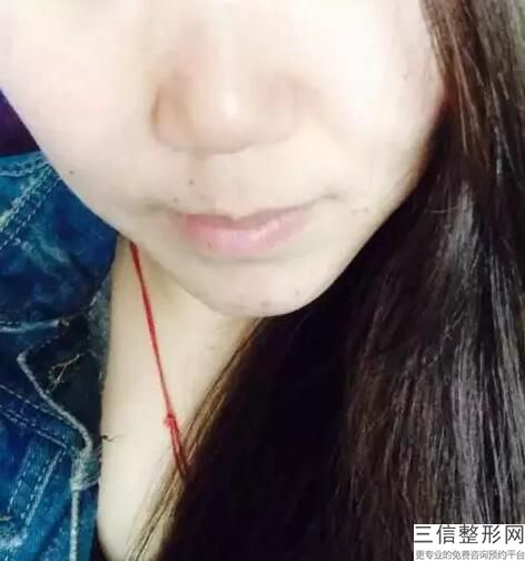 福建省十大皮肤美容医院吧！你知道吗？