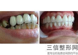 赣州口腔医院哪家好?排行榜前八强口碑测评