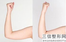 广州十大丰胸医院排名前十，广州华美医美医院