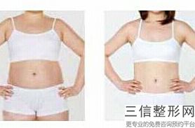 广州十大丰胸医院排名前十,你知道几个?