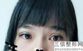 贵阳几家知名的双眼皮整形医院，欢迎对整形有兴趣