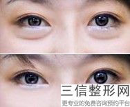 哈尔滨眼部整形哪家医院好？排名前十1、4