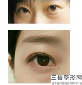 哈尔滨眼部整形哪家医院好？排名前十1、4