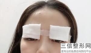 杭州双眼皮修复好的医生排名前八一，路新医生