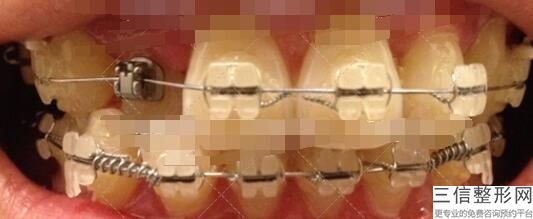 合肥口腔医院前十是哪家?合肥佳冠口腔诊所