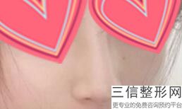 江西较新正规鼻整形医院名单，看看你是哪种？