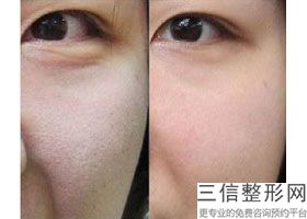 昆明有哪些整形医院有热玛吉？排行榜前八强热推