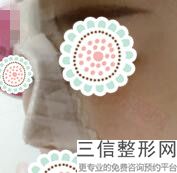 南京排名前10名隆鼻医生,这些医生都很好!