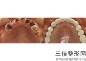 南宁排名前十的正畸医院有哪些?南宁口腔诊所