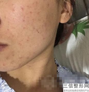 热玛姬的护肤效果越来越受爱美人士欢迎的热美琪医院