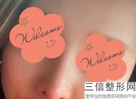 上海前10大鼻三甲整形医院，你了解多少？