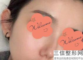 深圳做鼻综合整形医院哪里好，深圳美莱医疗美容医院