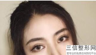 天津双眼皮医生排名前十名的天津名医供大家参考