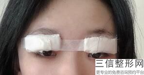 为什么现在整容去眼袋很受爱美人士的欢迎?