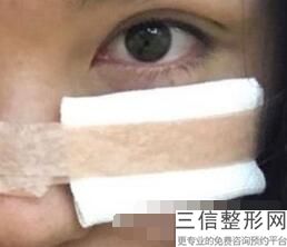 西安割双眼皮好的医院排名榜榜前十一