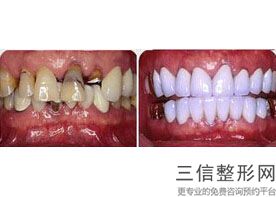 西安口腔专科医院哪家好？排名前八一，西安海涛口腔医院