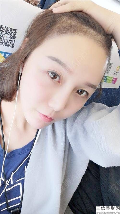 西安植发医院排名榜前八一，西安碧莲盛医院上榜