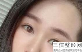 “眼科医生不做近视手术”的误解