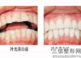 郑州口腔医院口腔正畸排名的十家医院