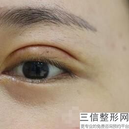 珠海眼科医院排名前五，中山大学附属第五医院