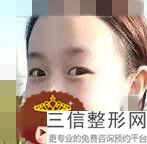 较新的成都十大正规双眼皮整形医院排名前十