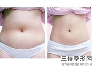 瘦的女孩子怎么丰胸，瘦女生如何丰胸