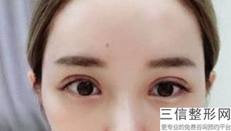 纹眼线效果好吗，纹眼线哪里纹得好看
