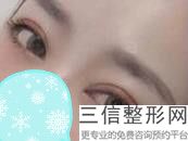 小切口眼部除皱手术,什么是小切口除皱术
