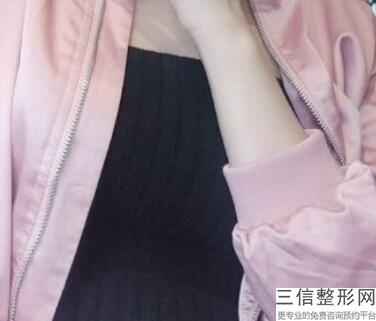 星熠光面假体隆胸，星熠假体隆胸价格