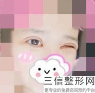 眼线纹完了多久能恢复，纹眼线要多长时间恢复
