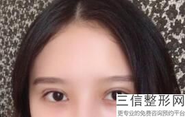 眼综合包括哪些项目，眼综合术式包括哪些