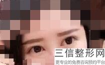 有了眼袋怎么办-三招轻松解决眼部问题，眼袋疼怎么回事