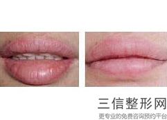 怎么让嘴唇变得好看，如何让嘴唇变好看-