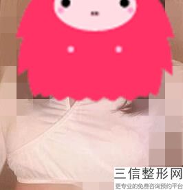 做乳晕漂染多少钱()，乳晕漂红手术是怎么做的