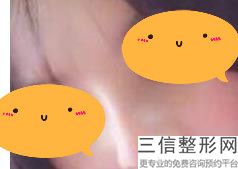 2022宁波隆鼻整形医院排行前十口碑推荐！宁波壹加壹美容整形医院排名靠前