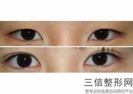 保定比较出名的眼部整形医院有哪些!保定驭颜医疗美容门诊部口碑良好