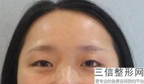 保定比较出名的眼部整形医院有哪些!保定驭颜医疗美容门诊部口碑良好