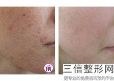 北京拉皮手术医院排名榜前十！北京京韩医疗美容诊所实力入围