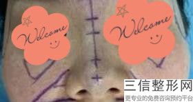 北京隆鼻医院排行榜！北京煤医医疗美容医院实力入围