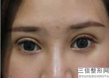 北京效果靠谱的眼科医院排名！实力上榜
